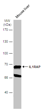 Mouse tissue extract (50 μg) was separated by 7.5% SDS-PAGE, and the membrane was blotted with IL1RAP antibody [N1N3] (GTX104513) diluted at 1:500. The HRP-conjugated anti-rabbit IgG antibody (GTX213110-01) was used to detect the primary antibody.