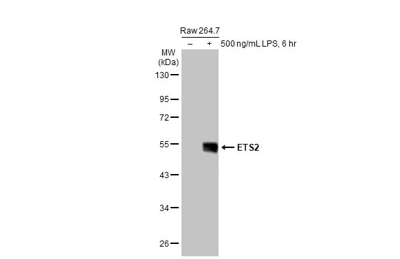 Untreated (–) and treated (+) Raw 264.7 whole cell extracts (30 μg) were separated by 10% SDS-PAGE, and the membrane was blotted with ETS2 antibody (GTX104527) diluted at 1:500. The HRP-conjugated anti-rabbit IgG antibody (GTX213110-01) was used to detect the primary antibody.