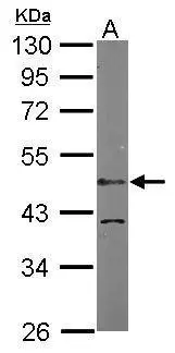 Sample (50 μg of whole cell lysate) A: Mouse brain 10% SDS PAGE GTX104531 diluted at 1:1000 The HRP-conjugated anti-rabbit IgG antibody (GTX213110-01) was used to detect the primary antibody.