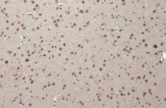 CSB antibody [N2C1], Internal detects CSB protein at nucleus by immunohistochemical analysis. Sample: Paraffin-embedded mouse brain. CSB stained by CSB antibody [N2C1], Internal (GTX104589) diluted at 1:500. Antigen Retrieval: Citrate buffer, pH 6.0, 15 min