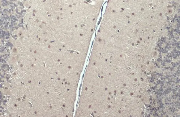 CSB antibody [N2C1], Internal detects CSB protein at nucleus by immunohistochemical analysis. Sample: Paraffin-embedded rat brain. CSB stained by CSB antibody [N2C1], Internal (GTX104589) diluted at 1:500. Antigen Retrieval: Citrate buffer, pH 6.0, 15 min