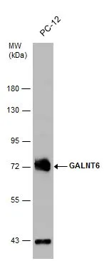 Whole cell extract (30 μg) was separated by 7.5% SDS-PAGE, and the membrane was blotted with GALNT6 antibody [N1C2] (GTX104602) diluted at 1:1000.