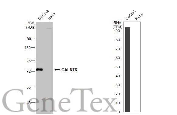 Various whole cell extracts (30 μg) were separated by 7.5% SDS-PAGE, and the membrane was blotted with GALNT6 antibody [N1C2] (GTX104602) diluted at 1:1000. The HRP-conjugated anti-rabbit IgG antibody (GTX213110-01) was used to detect the primary antibody. Corresponding RNA expression data for the same cell lines are based on Human Protein Atlas program.
