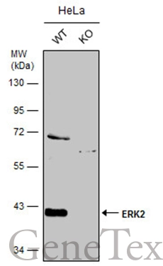 Wild-type (WT) and ERK2 knockout (KO) HeLa cell extracts (30 μg) were separated by 10% SDS-PAGE, and the membrane was blotted with ERK2 antibody [N1], N-term (GTX104613) diluted at 1:500. The HRP-conjugated anti-rabbit IgG antibody (GTX213110-01) was used to detect the primary antibody.