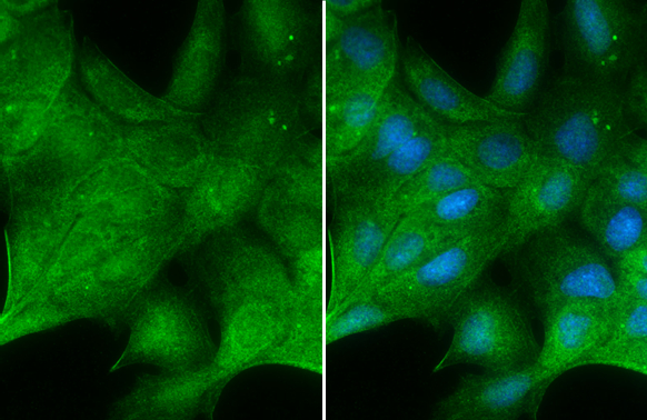 ERK2 antibody detects ERK2 protein at cytoplasm and nucleus by immunofluorescent analysis. Sample: MDCK cells were fixed in 4% paraformaldehyde at RT for 15 min. Green: ERK2 stained by ERK2 antibody (GTX104613) diluted at 1:500. Blue: Hoechst 33342 staining. ERK2 antibody detects ERK2 protein at cytoplasm and nucleus by immunofluorescent analysis. Sample: MDCK cells were fixed in 4% paraformaldehyde at RT for 15 min. Green: ERK2 stained by ERK2 antibody (GTX104613) diluted at 1:500. Blue: Hoechst 33342 staining.