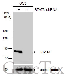 Non-transfected (–) and transfected (+) OC3 whole cell extracts (30 μg) were separated by 7.5% SDS-PAGE, and the membrane was blotted with STAT3 antibody [C3], C-term (GTX104616) diluted at 1:500. The HRP-conjugated anti-rabbit IgG antibody (GTX213110-01) was used to detect the primary antibody.