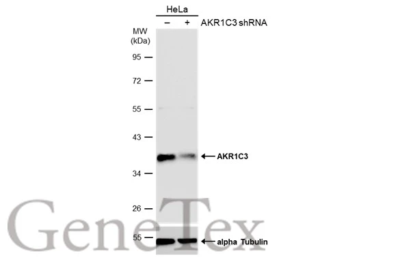 Non-transfected (–) and transfected (+) HeLa whole cell extracts (50 μg) were separated by 10% SDS-PAGE, and the membrane was blotted with AKR1C3 antibody [C2C3], C-term (GTX104627) diluted at 1:20000. The HRP-conjugated anti-rabbit IgG antibody (GTX213110-01) was used to detect the primary antibody.