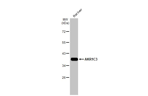 Rat tissue extract (50 μg) was separated by 10% SDS-PAGE, and the membrane was blotted with AKR1C3 antibody [C2C3], C-term (GTX104627) diluted at 1:2000. The HRP-conjugated anti-rabbit IgG antibody (GTX213110-01) was used to detect the primary antibody.