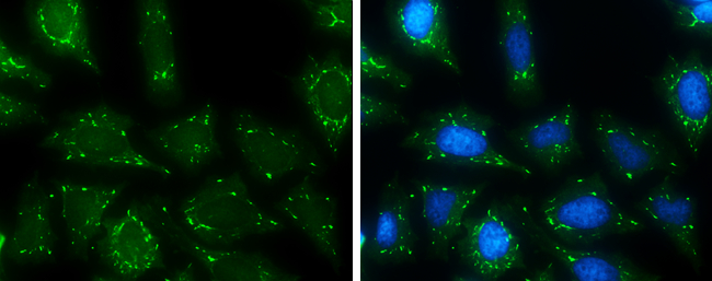 USP15 antibody [C3], C-term detects USP15 protein by immunofluorescent analysis. Sample: HeLa cells were fixed in 4% paraformaldehyde at RT for 15 min. Green: USP15 stained by USP15 antibody [C3], C-term (GTX104644) diluted at 1:500. Blue: Hoechst 33342 staining.