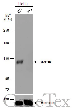 Wild-type (WT) and USP15 knockout (KO) HeLa cell extracts (30 μg) were separated by 5% SDS-PAGE, and the membrane was blotted with USP15 antibody [C3], C-term (GTX104644) diluted at 1:1000. The HRP-conjugated anti-rabbit IgG antibody (GTX213110-01) was used to detect the primary antibody.