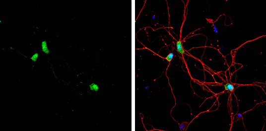CPEB1 antibody [C3], C-term detects CPEB1 protein by immunofluorescent analysis. Sample: DIV9 rat E18 primary hippocampal neuron cells were fixed in 4% paraformaldehyde at RT for 15 min. Green: CPEB1 stained by CPEB1 antibody [C3], C-term (GTX104682) diluted at 1:500. Red: beta Tubulin 3/ Tuj1, stained by beta Tubulin 3/ Tuj1 antibody [GT11710] (GTX631836) diluted at 1:500. Blue: Fluoroshield with DAPI (GTX30920).