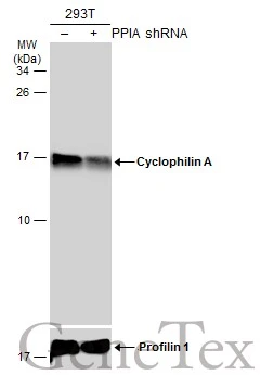 Anti-Cyclophilin A antibody [C1C3] (GTX104698) | GeneTex