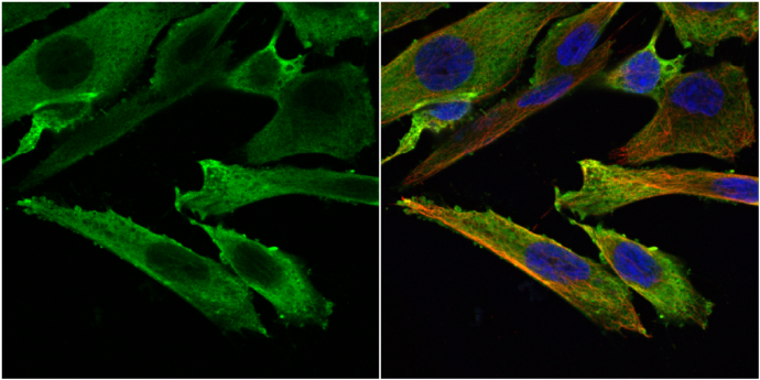 Stathmin 1 antibody detects Stathmin 1 protein at cytoplasm by immunofluorescent analysis. Sample: SK-N-SH cells were fixed in 4% paraformaldehyde at RT for 15 min. Green: Stathmin 1 protein stained by Stathmin 1 antibody (GTX104707) diluted at 1:500. Red: alpha Tubulin, a cytoskeleton marker, stained by alpha Tubulin antibody [GT114] (GTX628802) diluted at 1:1000. Blue: Hoechst 33342 staining.