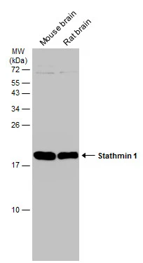 Various tissue extracts (50 μg) were separated by 15% SDS-PAGE, and the membrane was blotted with Stathmin 1 antibody (GTX104707) diluted at 1:5000. The HRP-conjugated anti-rabbit IgG antibody (GTX213110-01) was used to detect the primary antibody.