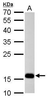 Stathmin 1 antibody detects STMN1 protein by Western blot analysis. A. 50 μg mouse brain lysate/extract 12 % SDS-PAGE Stathmin 1 antibody (GTX104707) dilution: 1:10000