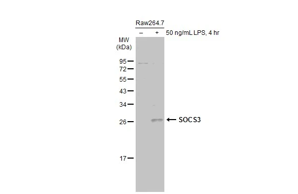 Untreated (–) and treated (+) Raw264.7 whole cell extracts (30 μg) were separated by 12% SDS-PAGE, and the membrane was blotted with SOCS3 antibody [C2C3], C-term (GTX104720) diluted at 1:500. The HRP-conjugated anti-rabbit IgG antibody (GTX213110-01) was used to detect the primary antibody, and the signal was developed with Trident ECL plus-Enhanced.
