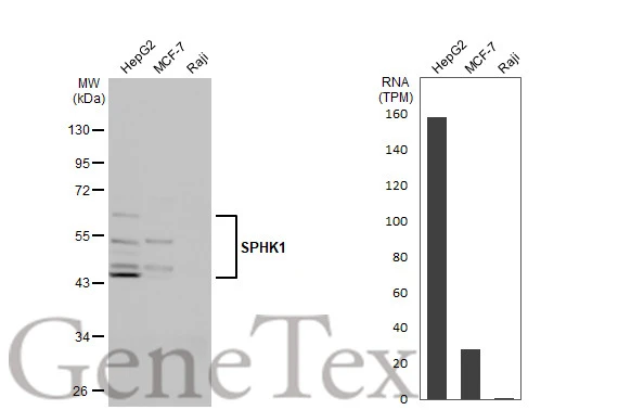 SPHK1 antibody [C3], C-term