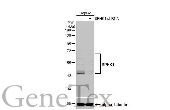 Non-transfected (–) and transfected (+) HepG2 whole cell extracts (30 μg) were separated by 10% SDS-PAGE, and the membrane was blotted with SPHK1 antibody [C3], C-term (GTX104724) diluted at 1:1000. The HRP-conjugated anti-rabbit IgG antibody (GTX213110-01) was used to detect the primary antibody.