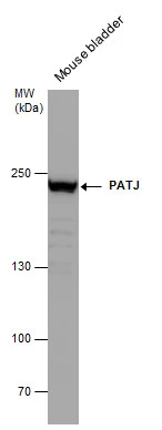 Mouse tissue extract (50 μg) was separated by 5% SDS-PAGE, and the membrane was blotted with PATJ antibody [N1], N-term (GTX104753) diluted at 1:500.