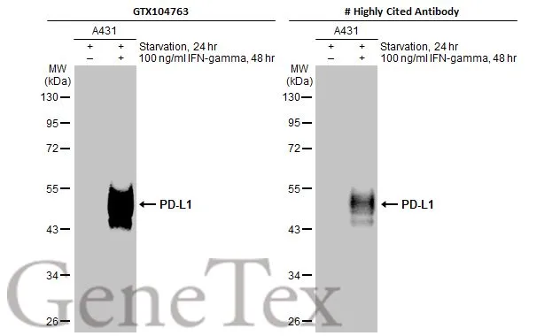 Anti-PD-L1 antibody (GTX104763) | GeneTex
