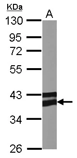 Adiponectin Receptor 1 antibody [C2C3], C-term