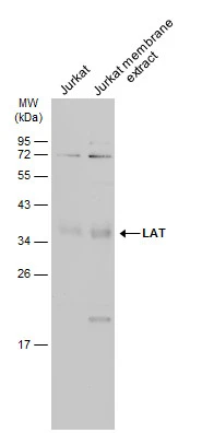 Jurkat whole cell and membrane extracts (30 μg) were separated by 12% SDS-PAGE, and the membrane was blotted with LAT antibody (GTX104771) diluted at 1:500. The HRP-conjugated anti-rabbit IgG antibody (GTX213110-01) was used to detect the primary antibody, and the signal was developed with Trident ECL plus-Enhanced.