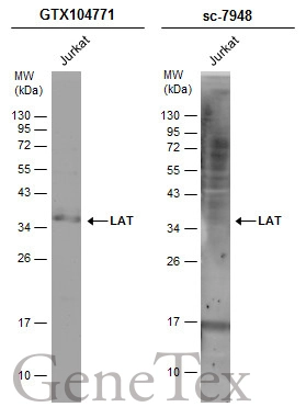 Whole cell extract (30 μg) was separated by 12% SDS-PAGE, and the membranes were blotted with LAT antibody (GTX104771) diluted at 1:500 and competitor's antibody (sc-7948) diluted at 1:1000. The HRP-conjugated anti-rabbit IgG antibody (GTX213110-01) was used to detect the primary antibody.