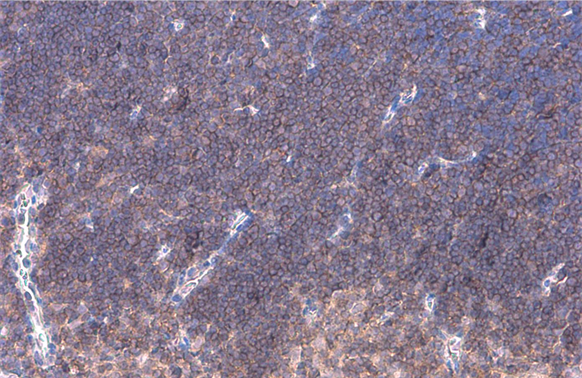 LAT antibody detects LAT protein at cell membrane by immunohistochemical analysis. Sample: Paraffin-embedded mouse thymus gland. LAT stained by LAT antibody (GTX104771) diluted at 1:500. Antigen Retrieval: Citrate buffer, pH 6.0, 15 min
