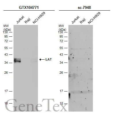 Various whole cell extracts (30 μg) were separated by 12% SDS-PAGE, and the membranes were blotted with LAT antibody (GTX104771) diluted at 1:1000 and competitor's antibody (sc-7948) diluted at 1:1000. The HRP-conjugated anti-rabbit IgG antibody (GTX213110-01) was used to detect the primary antibody. *The competitor is not affiliated with GeneTex and does not endorse this product.