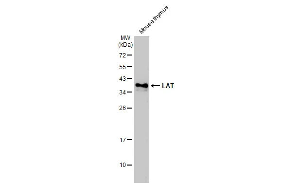 Mouse tissue extract (50 μg) was separated by 12% SDS-PAGE, and the membrane was blotted with LAT antibody (GTX104771) diluted at 1:1000. The HRP-conjugated anti-rabbit IgG antibody (GTX213110-01) was used to detect the primary antibody.