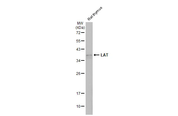 Rat tissue extract (50 μg) was separated by 12% SDS-PAGE, and the membrane was blotted with LAT antibody (GTX104771) diluted at 1:1000. The HRP-conjugated anti-rabbit IgG antibody (GTX213110-01) was used to detect the primary antibody.