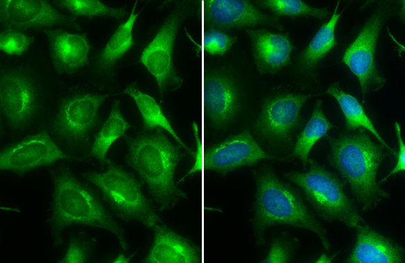 ARF5 antibody detects ARF5 protein at Golgi apparatus and cytoplasm by immunofluorescent analysis. Sample: HeLa cells were fixed in 4% paraformaldehyde at RT for 15 min. Green: ARF5 stained by ARF5 antibody (GTX104783) diluted at 1:500. Blue: Hoechst 33342 staining.