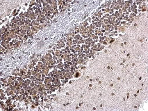 COUP TF1 antibody [N1], N-term detects COUP TF1 protein at nucleus on mouse hind brain by immunohistochemical analysis. Sample: Paraffin-embedded mouse hind brain. COUP TF1 antibody [N1], N-term (GTX104801) diluted at 1:500. 
 Antigen Retrieval: Trilogy? (EDTA based, pH 8.0) buffer, 15min