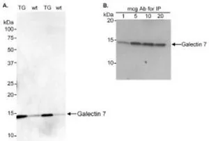 A : WB analysis of TG (COX2 transgenic mice) / WT (FVB wild-type mice) using GTX10482 Galectin 7 antibody. B : IP analysis of FVB wild-type mice using GTX10482 Galectin 7 antibody.