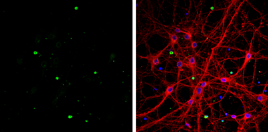 OLIG1 antibody [C2C3], C-term detects OLIG1 protein by immunofluorescent analysis. Sample: DIV9 rat E18 primary cortical neurons and glia cells were fixed in 4% paraformaldehyde at RT for 15 min. Green: OLIG1 protein stained by OLIG1 antibody [C2C3], C-term (GTX104823) diluted at 1:500. Red: beta Tubulin 3/ Tuj1, stained by beta Tubulin 3/ Tuj1 antibody [GT886] (GTX631830) diluted at 1:500. Blue: Fluoroshield with DAPI (GTX30920).