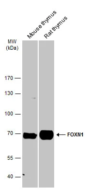 Various tissue extracts (50 μg) were separated by 7.5% SDS-PAGE, and the membrane was blotted with FOXN1 antibody [C3], C-term (GTX104849) diluted at 1:500. The HRP-conjugated anti-rabbit IgG antibody (GTX213110-01) was used to detect the primary antibody.