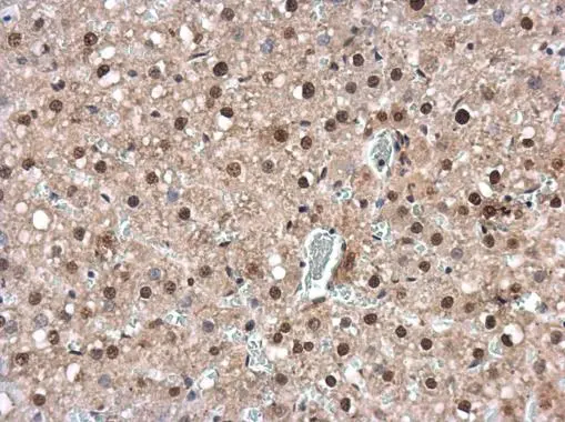 IRF6 antibody [C3], C-term detects IRF6 protein at cytoplasm and nucleus in rat liver by immunohistochemical analysis. Sample: Paraffin-embedded rat liver. IRF6 antibody [C3], C-term (GTX104862) diluted at 1:500. 
 Antigen Retrieval: Citrate buffer, pH 6.0, 15 min
