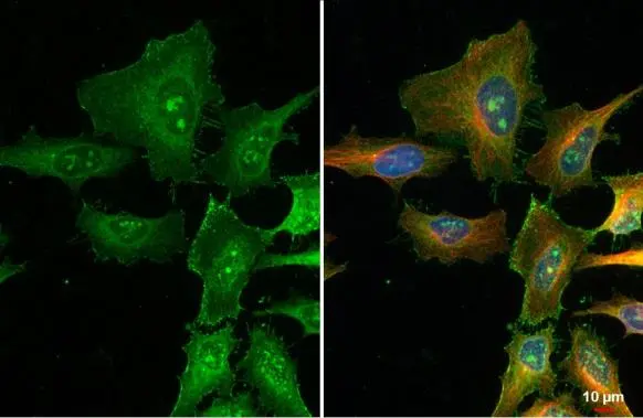 FBXL2 antibody [N1], N-term detects FBXL2 protein at nucleolus by immunofluorescent analysis. Sample: HeLa cells were fixed in ice-cold MeOH for 5 min. Green: FBXL2 stained by FBXL2 antibody [N1], N-term (GTX104864) diluted at 1:500. Red: alpha Tubulin, a cytoskeleton marker, stained by alpha Tubulin antibody [GT114] (GTX628802) diluted at 1:1000. Blue: Fluoroshield with DAPI (GTX30920).