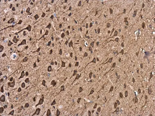 Kinesin 5A antibody [C3], C-term detects Kinesin 5A protein at cytoplasm in rat brain by immunohistochemical analysis. Sample: Paraffin-embedded rat brain. Kinesin 5A antibody [C3], C-term (GTX104875) diluted at 1:500. 
 Antigen Retrieval: Citrate buffer, pH 6.0, 15 min