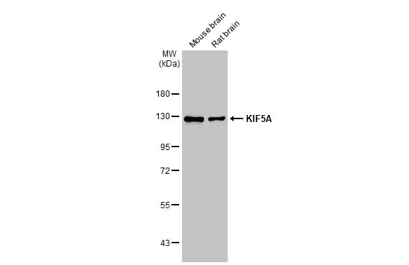 Various tissue extracts (50 μg) were separated by 7.5% SDS-PAGE, and the membrane was blotted with KIF5A antibody [C3], C-term (GTX104875) diluted at 1:1000. The HRP-conjugated anti-rabbit IgG antibody (GTX213110-01) was used to detect the primary antibody, and the signal was developed with Trident ECL plus-Enhanced.