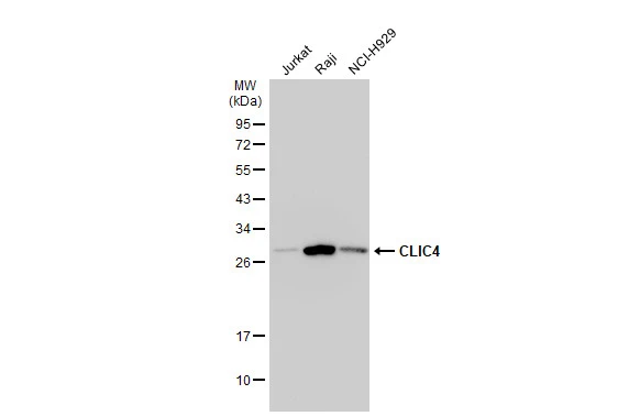Various whole cell extracts (30 μg) were separated by 12% SDS-PAGE, and the membrane was blotted with CLIC4 antibody (GTX104888) diluted at 1:1000. The HRP-conjugated anti-rabbit IgG antibody (GTX213110-01) was used to detect the primary antibody.