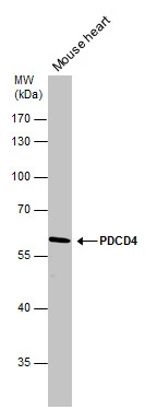 PDCD4 antibody detects PDCD4 protein by western blot analysis. Mouse tissue extracts (50 μg) was separated by 10% SDS-PAGE, and the membrane was blotted with PDCD4 antibody (GTX104901) diluted at 1:1000.