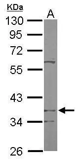 Sample (50 ug of whole cell lysate) A: Mouse brain 10% SDS PAGE GTX104912 diluted at 1:1000 Sample (50 ug of whole cell lysate) A: Mouse brain 10% SDS PAGE GTX104912 diluted at 1:1000