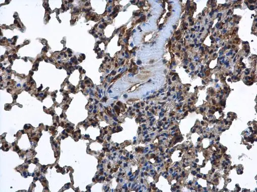 FARSLA antibody [N2C2], Internal detects FARSLA protein at cytoplasm in mouse lung by immunohistochemical analysis. Sample: Paraffin-embedded mouse lung. FARSLA antibody [N2C2], Internal (GTX104924) diluted at 1:500. 
 Antigen Retrieval: Citrate buffer, pH 6.0, 15 min