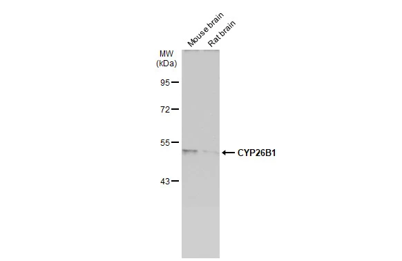 Various tissue extracts (50 μg) were separated by 7.5% SDS-PAGE, and the membrane was blotted with CYP26B1 antibody [N2C2], Internal (GTX104932) diluted at 1:1000. The HRP-conjugated anti-rabbit IgG antibody (GTX213110-01) was used to detect the primary antibody.