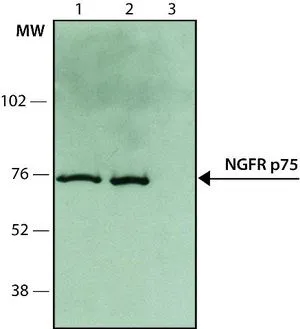 WB analysis of various samples using GTX10494 p75 NGF Receptor / CD271 antibody at 1:5000. Lane 1: Rat brain Lane 2: 50 ng/ml NGF-differentiated PC12 cells Lane 3: Negative control: non-treated PC12 cells