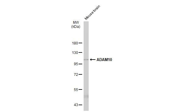 Mouse tissue extract (50 μg) was separated by 7.5% SDS-PAGE, and the membrane was blotted with ADAM10 antibody [N2C1], Internal (GTX104940) diluted at 1:1000. The HRP-conjugated anti-rabbit IgG antibody (GTX213110-01) was used to detect the primary antibody, and the signal was developed with Trident ECL plus-Enhanced.