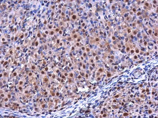 RGS2 antibody detects RGS2 protein at cytoplasm and nucleus in rat ovary by immunohistochemical analysis. Sample: Paraffin-embedded rat ovary. RGS2 antibody (GTX104944) diluted at 1:500. 
 Antigen Retrieval: Citrate buffer, pH 6.0, 15 min