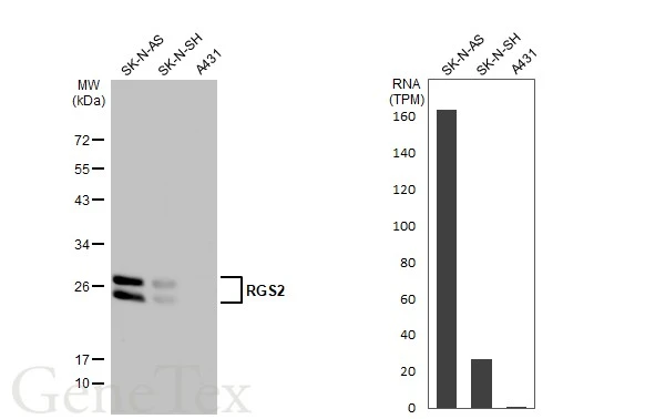 Various whole cell extracts (30 μg) were separated by 12% SDS-PAGE, and the membrane was blotted with RGS2 antibody (GTX104944) diluted at 1:1000. The HRP-conjugated anti-rabbit IgG antibody (GTX213110-01) was used to detect the primary antibody.