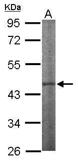 Sample (50 μg of whole cell lysate) A: Mouse brain 10% SDS PAGE GTX104954 diluted at 1:1000 The HRP-conjugated anti-rabbit IgG antibody (GTX213110-01) was used to detect the primary antibody.